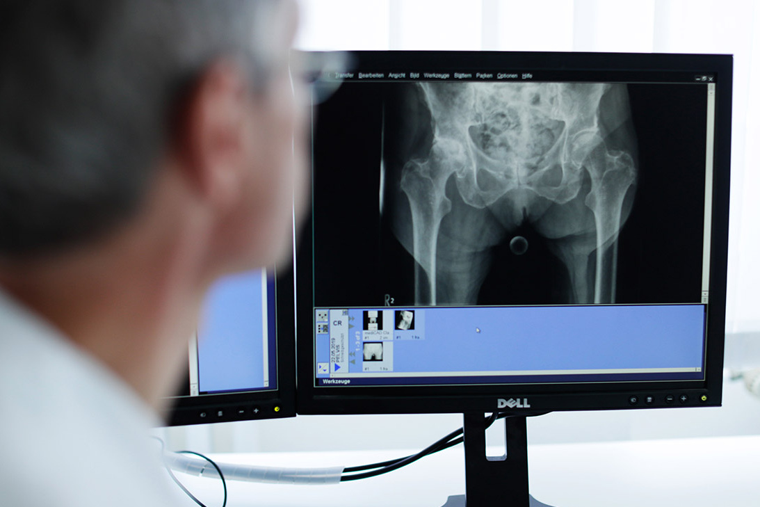 Röntgenbild Unfallchirurgie